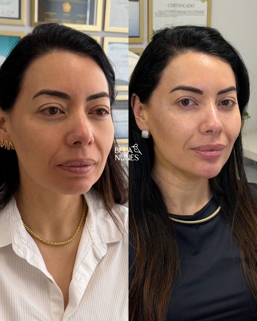 Resultado 7: antes e depois