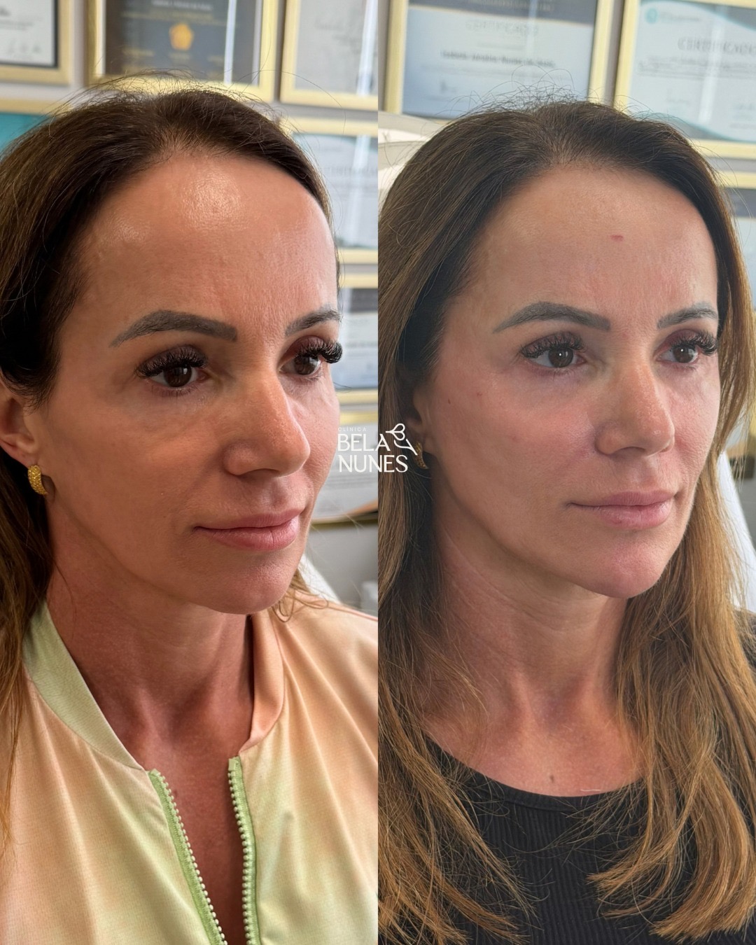 Resultado 8: antes e depois