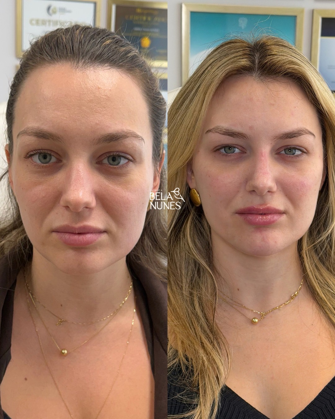 Resultado 9: antes e depois