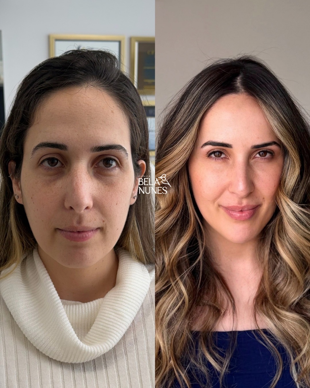 Resultado 10: antes e depois