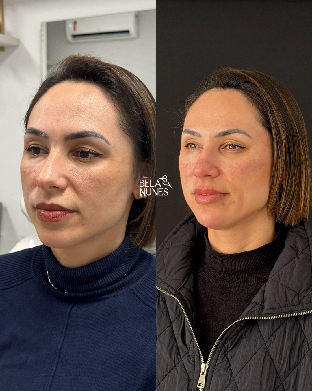 Resultado 12: antes e depois