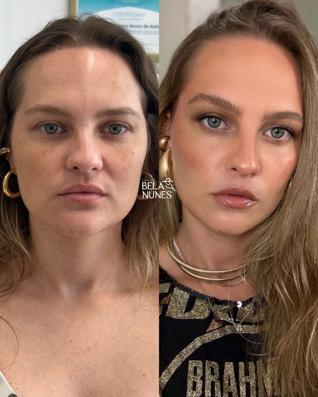 Resultado 15: antes e depois