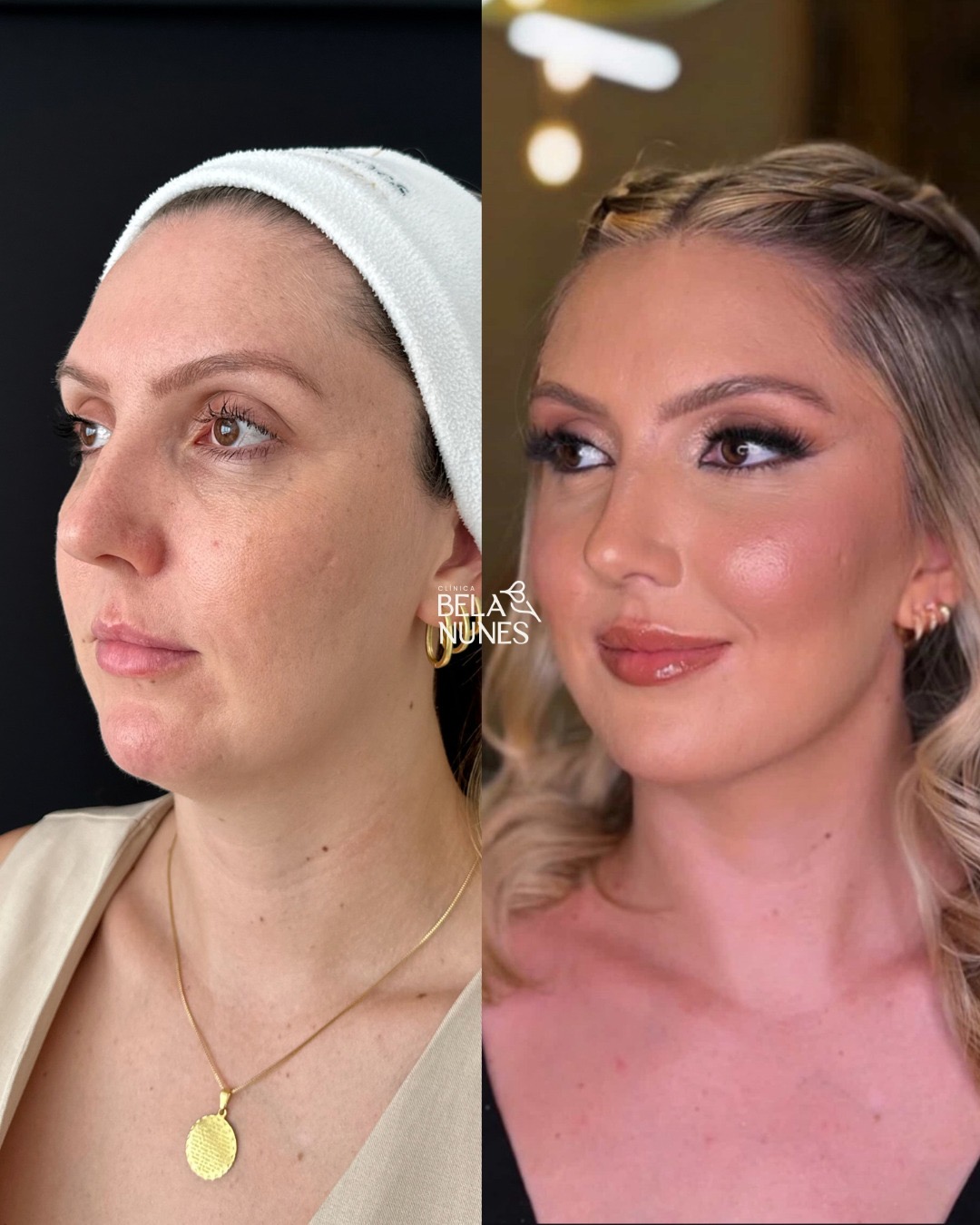Resultado 18: antes e depois