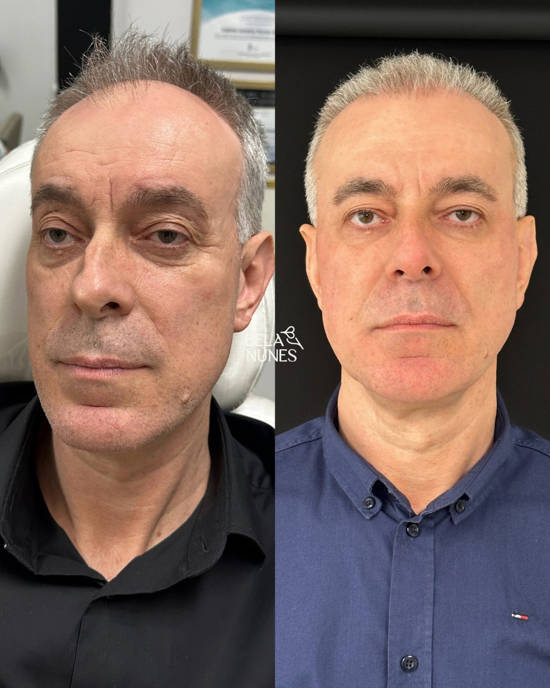 Resultado 19: antes e depois