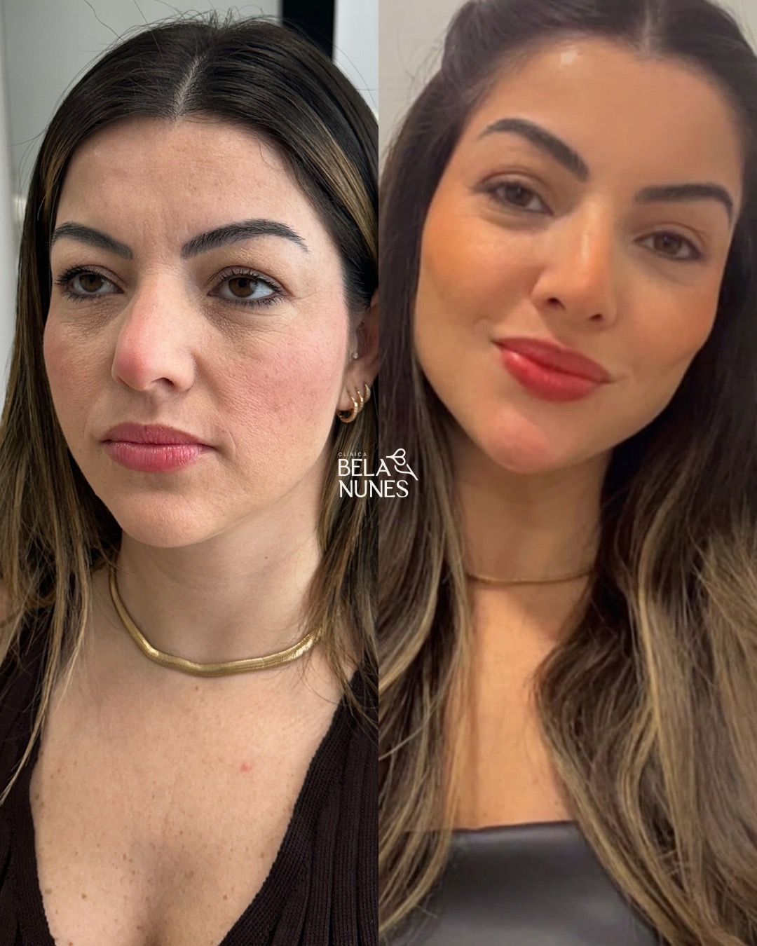 Resultado 20: antes e depois