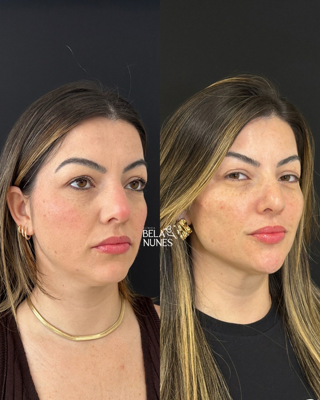 Resultado 24: antes e depois
