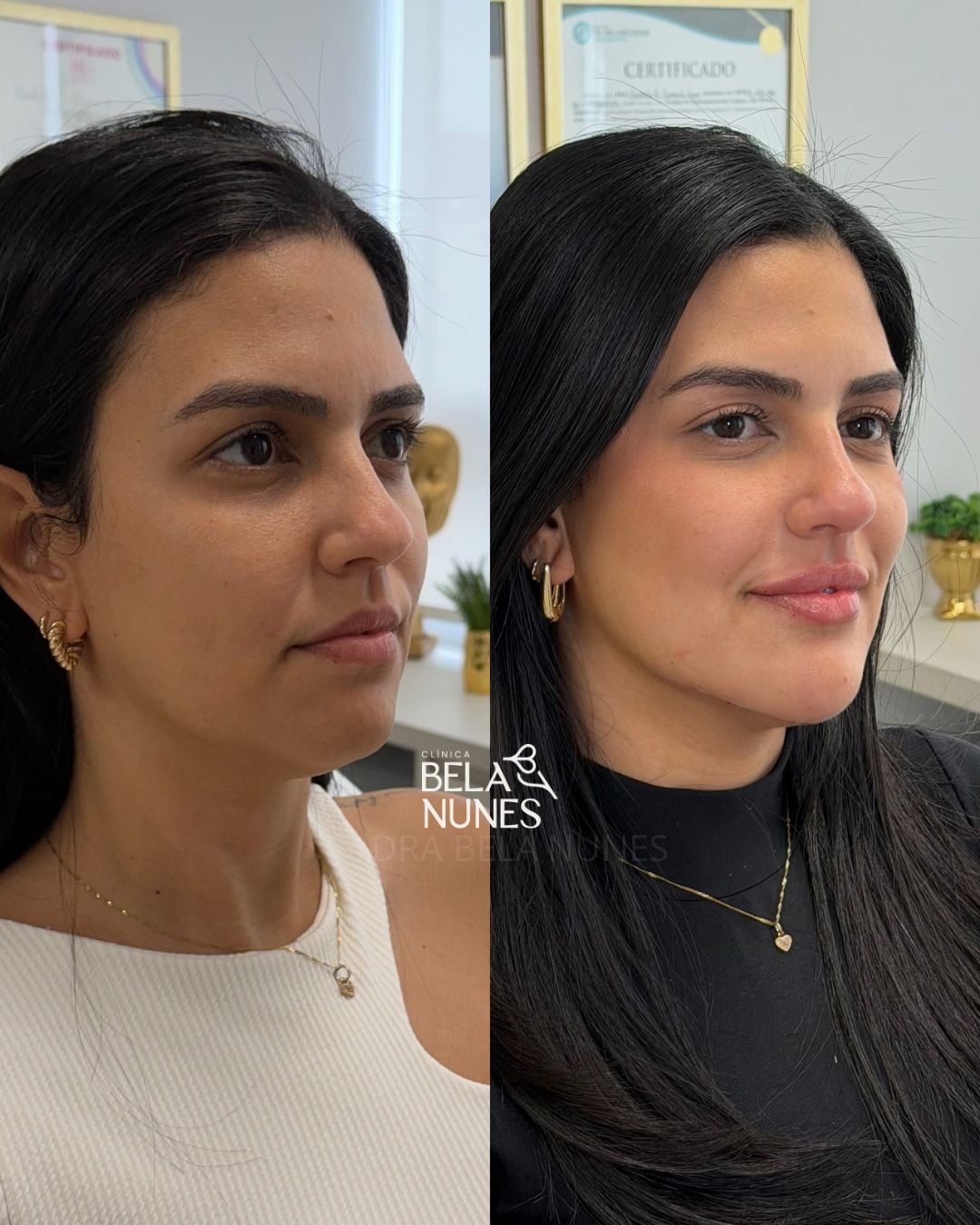 Resultado 28: antes e depois