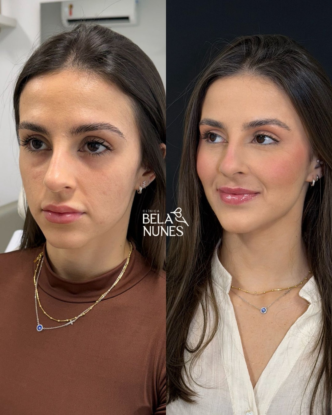 Resultado 29: antes e depois