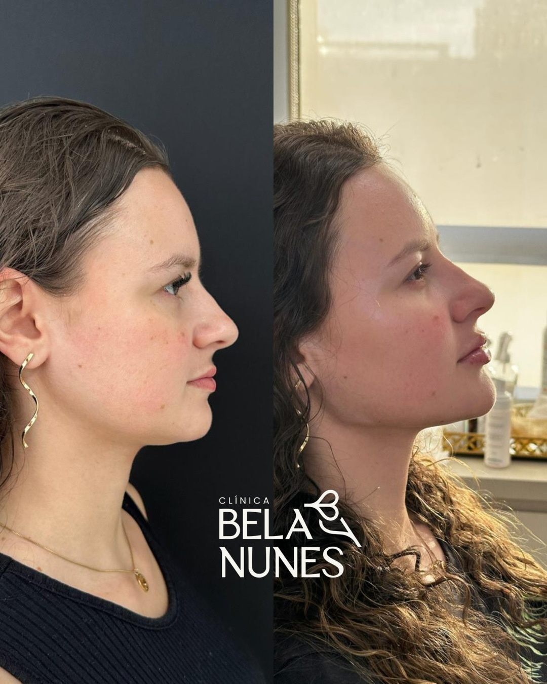 Resultado 30: antes e depois