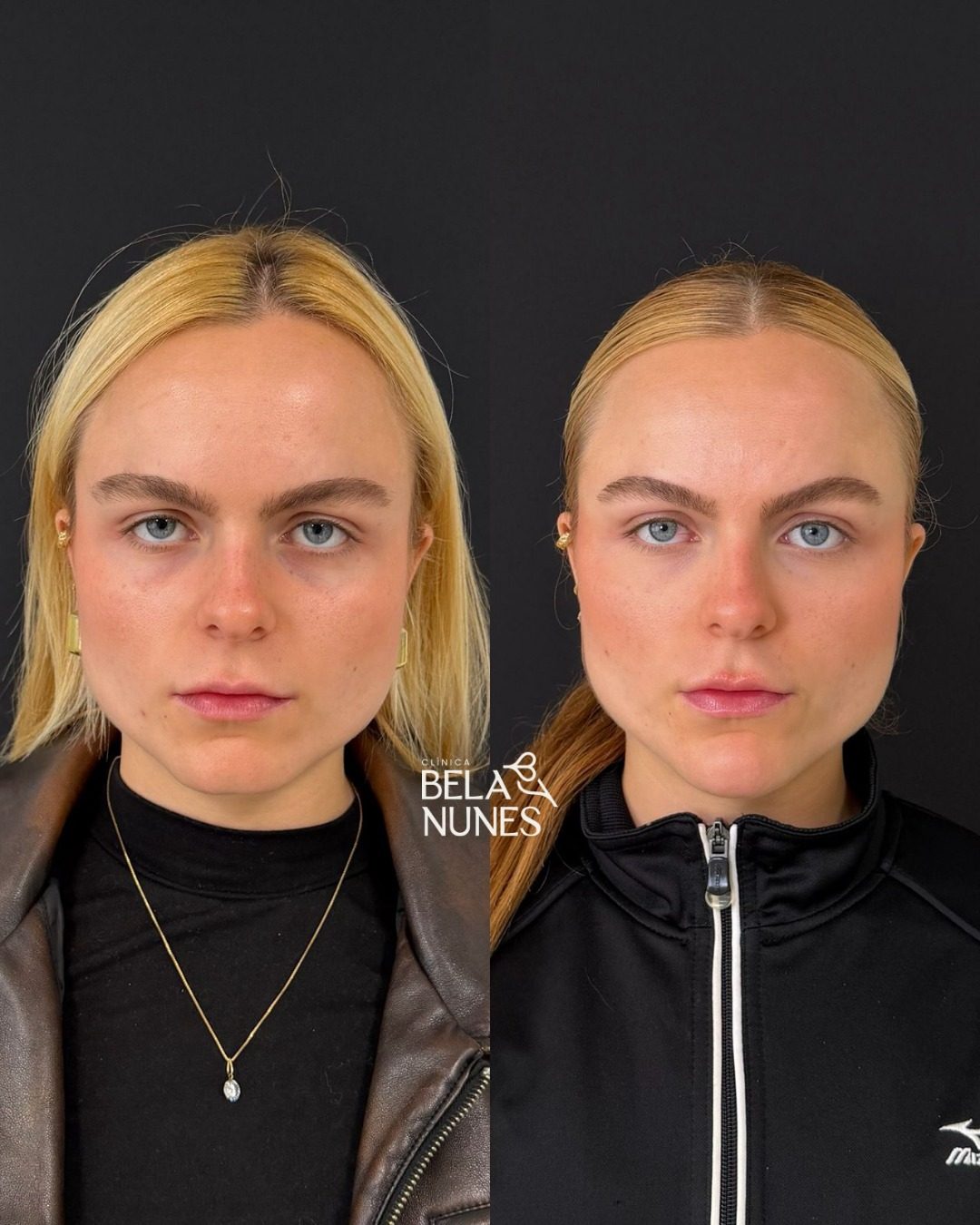 Resultado 2: antes e depois