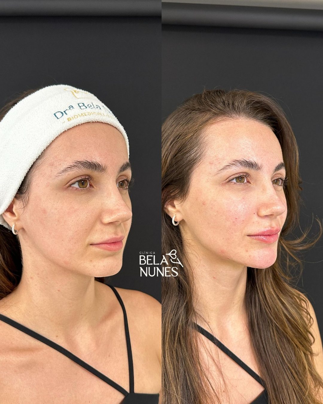 Resultado 3: antes e depois