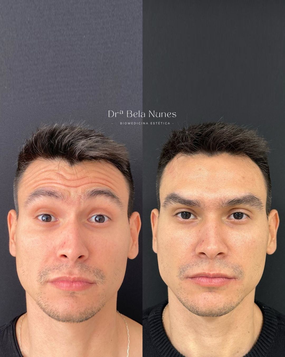 Resultado 4: antes e depois